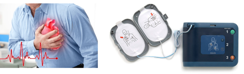 การใช้เครื่อง AED ระหว่างที่ทีมกู้ชีพ