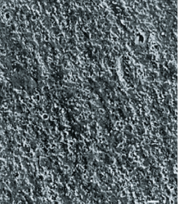 ผ้าไมโครพอร์ (Microporous fabric)